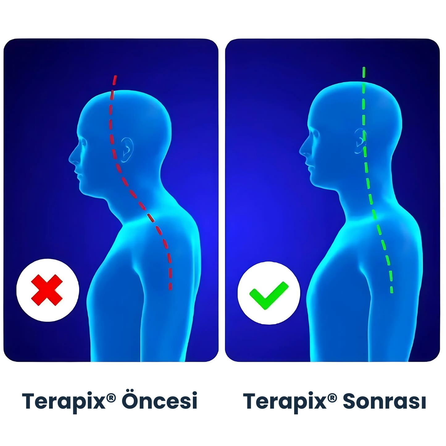 Terapix® Boyun Masaj Yastığı